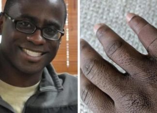 La emoción de un hombre al encontrar una curita negra para su piel