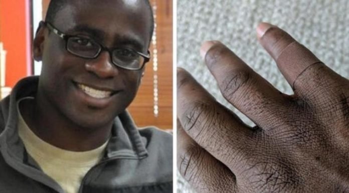 La emoción de un hombre al encontrar una curita negra para su piel