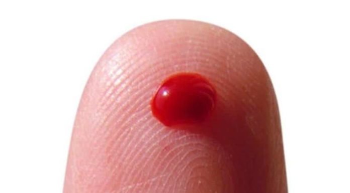 JAPÓN: CREAN TECNOLOGÍA QUE DETECTA CÁNCER CON UNA SOLA GOTA DE SANGRE